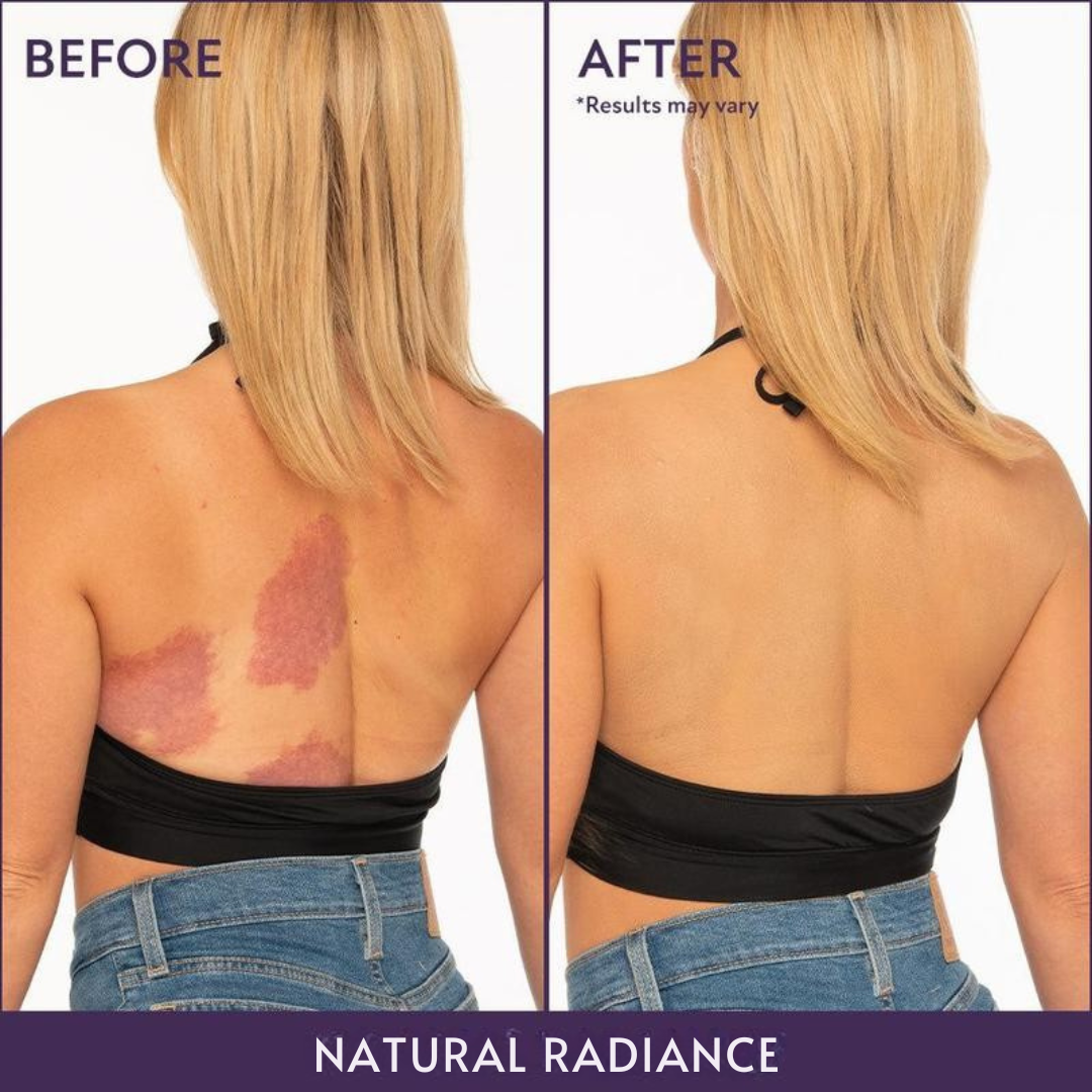 Vintiva™ Body Coverage Perfector