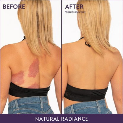 Vintiva™ Body Coverage Perfector